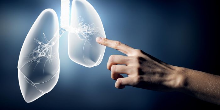 Mycobacterial Lung Disease, FDA Approves New Drug