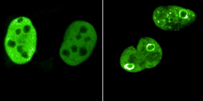 How a Master Regulator May be Working to Protect Cancer