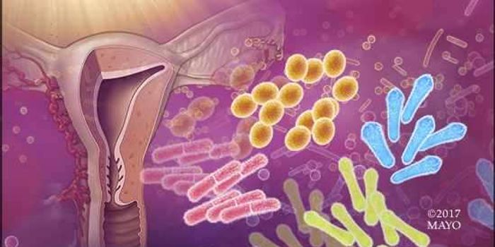 Vaginal Microbes Linked to Endometrial Cancer