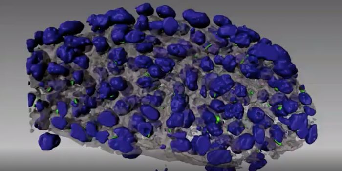 Insights Into the Cause of Mitral Valve Prolapse