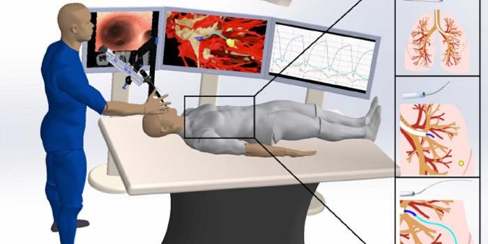 AI-Driven Autonomous Needle Robot Aims to Revolutionize Lung Cancer Treatment
