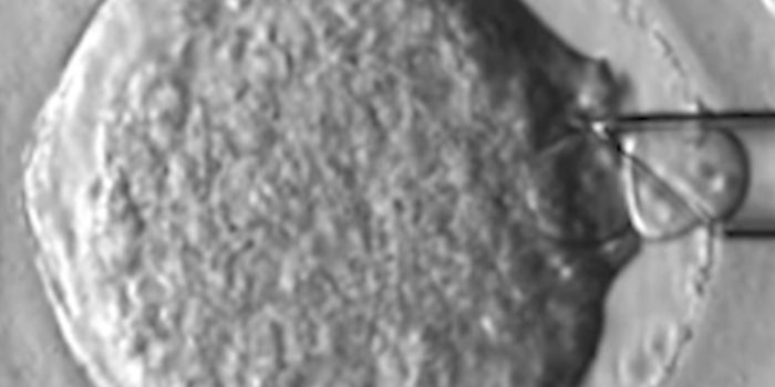 The UK's First '3 Person Baby'