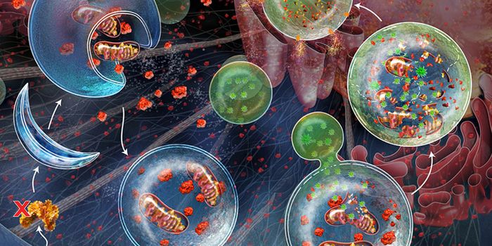 Macrophage Buildup Exacerbates Atherosclerosis