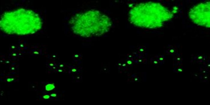 Noise-related Hearing Loss Might be in Your Genes