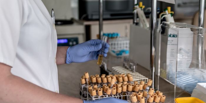 A Blood Test Could Detect Cancer Before a CT Scan or MRI