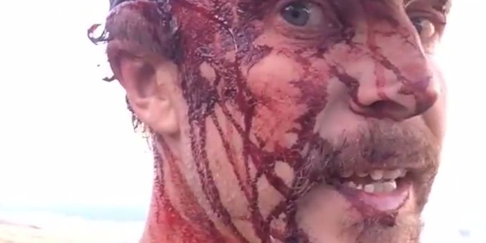 Man Mauled By Grizzly Bear Twice Lives to Tell the Tale