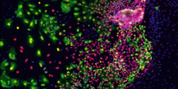 Mutated Gene Significantly Lowers Our Flu Defenses