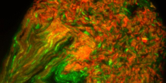 25% of Antibiotic-Resistant Bacteria Can Spread Resistance Directly to Other Microbes