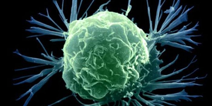 Diabetes Drug Could Help Fight Cancer