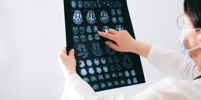 Study Explores Role of Cannabinoid Receptor Type 2 Activity in Granulocyte Colony-Stimulating Factor (G-CSF) Treatment for Traumatic Brain Injury (TBI)