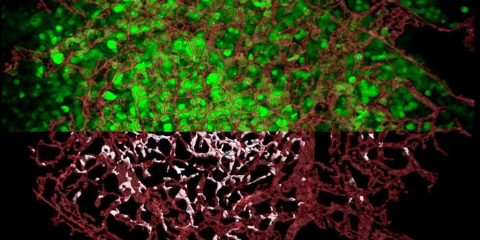 At Last, a Clue to Where Cancer Metastases Are Born