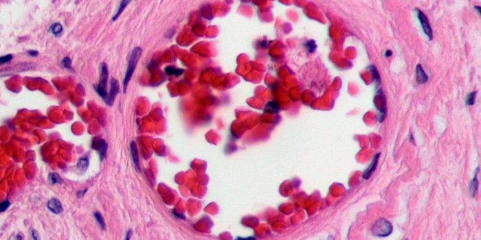 Treating TTP with Synthetic Antibodies