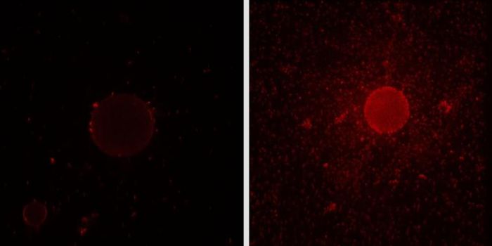 Some Bacteria Make a Kind of Detergent & Could Help Clean Oil Spills