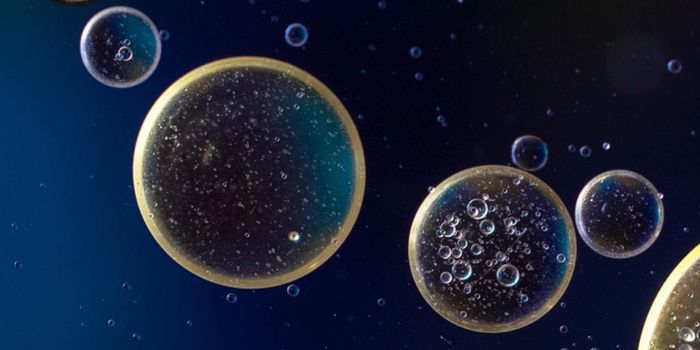 Explaining the Significant Sex Differences in Lupus