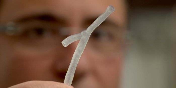 3D Printing Makes Models of Heart Disease Better Than Ever
