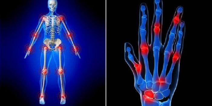 Controlling Chronic Inflammation with UV Light to Quell Disease Symptoms