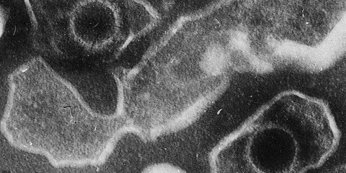 Epstein-Barr Virus Raises Risk of 7 Diseases in Addition to Mono