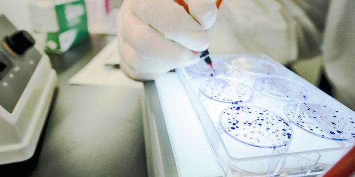 New Cancer Drug Could Result from 6 Molecules That Block HuR