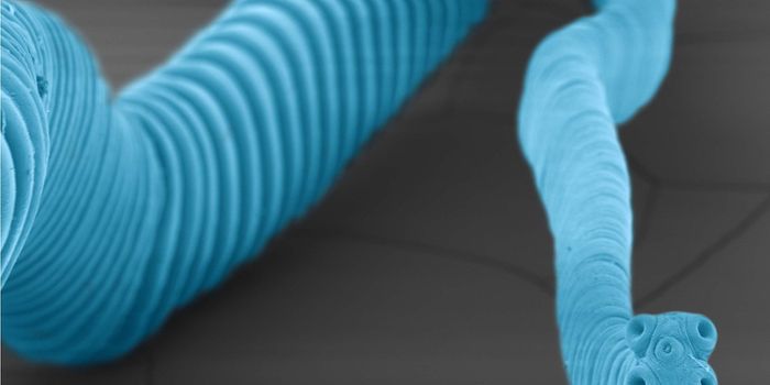 Man Dies From Tumors Passed On to Him By Tapeworm