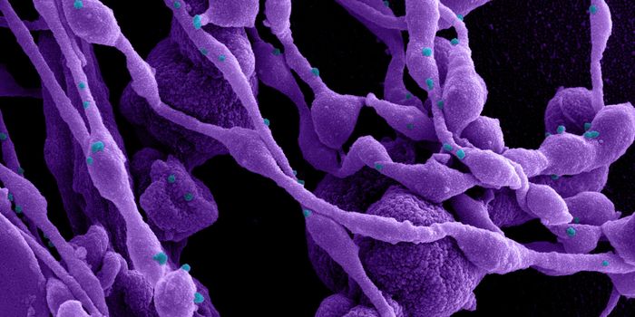 Taking Aim at the Sugar Coat of the SARS-CoV-2 Spike Protein