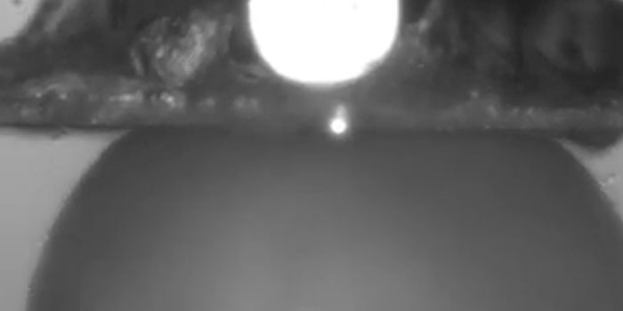 Stopping Structural Changes in Collagen may Prevent Lung Fibrosis