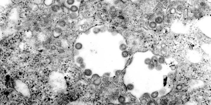 Rift Valley Fever's Infectious Secret is Revealed