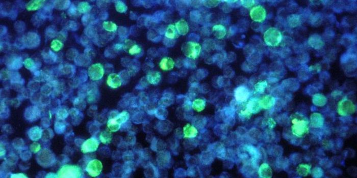 How Epstein-Barr Virus & Genetic Factors Can Lead to Multiple Sclerosis