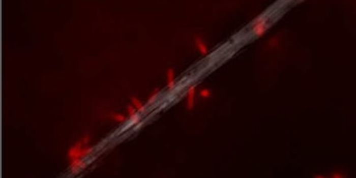 Some Microbes Can Survive Solely on Electricity