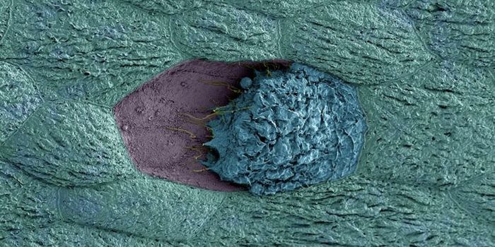 Vaginal Bacterium may be to Blame for Recurrent UTIs