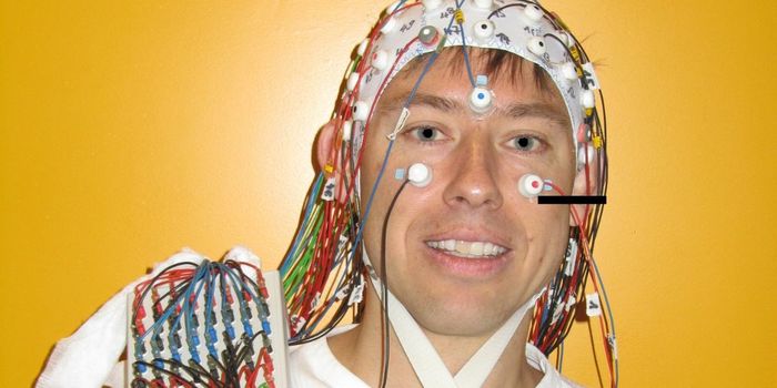 Shorter Reinforcement Delays Make Neurofeedback More Effective