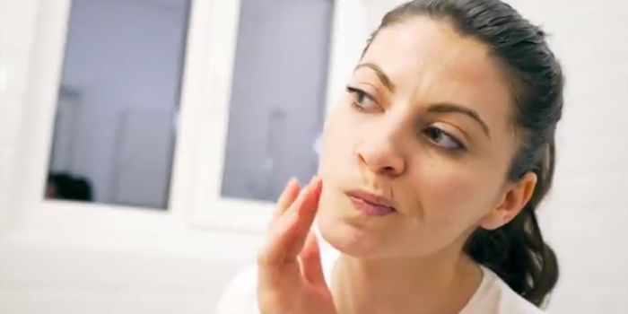 Tips for Preventing Acne