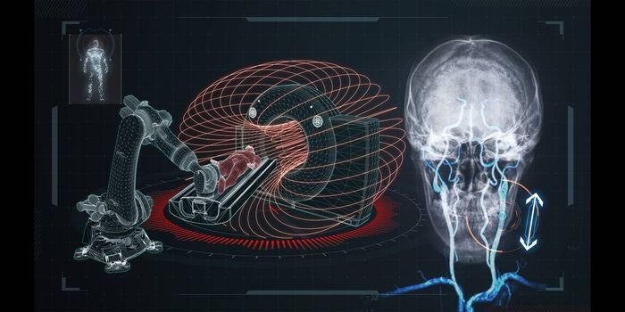 Magnetic Field-guided Tethered-probe Can Navigate Complex Vascular Networks