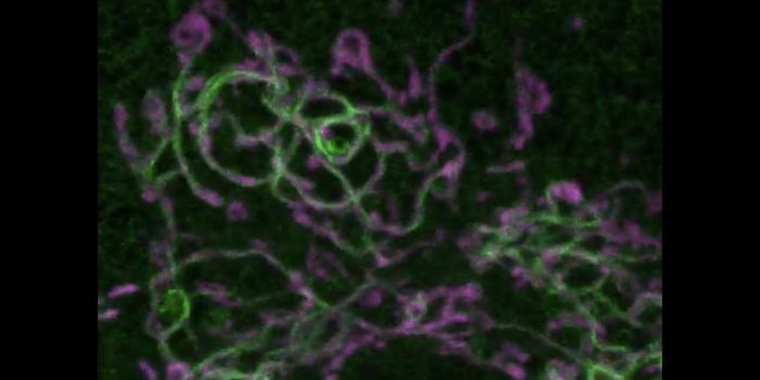 New Microscopy Tools Reveal More About the Role of Actin