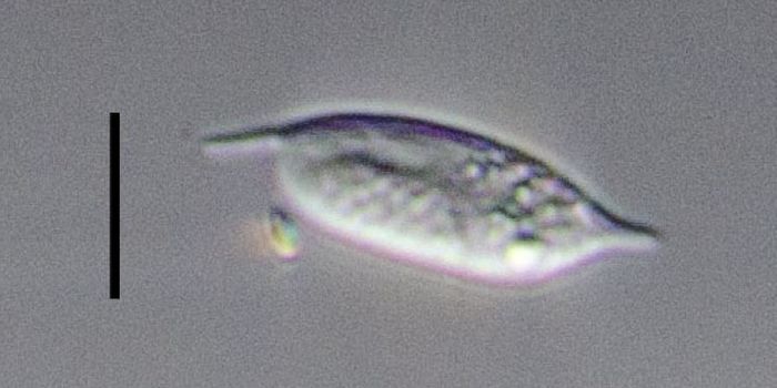 At Last, Direct Observation of Abundant, Elusive Ocean Microbe