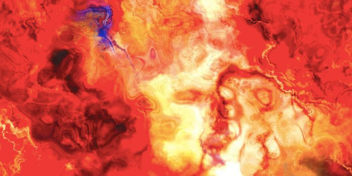 Researchers Find Cause of Flares in Rare Autoinflammatory Disease