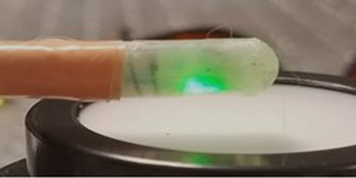 Photoacoustic endoscopy could improve Crohn's disease treatment