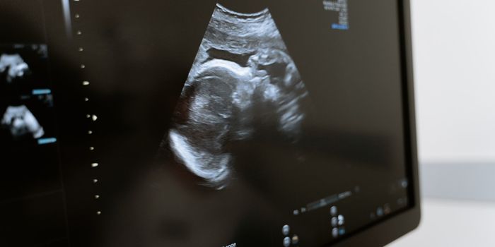 Drug Delivery System Helps Treat Ectopic Pregnancies