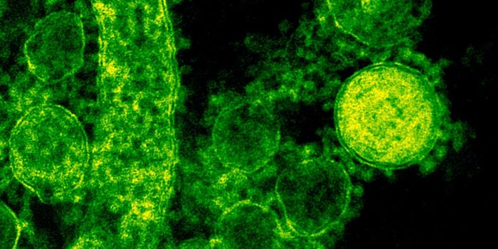 New Sensor Helps Determine How Bacteria Will Respond to Antibiotics