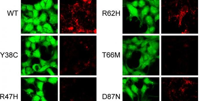 TREM2 Mutant Explains Microglia Dysfunction, Alzheimer's Disease