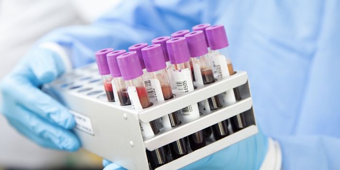 New Blood Test Could 'Transform' Diagnostics for Kids' Fevers