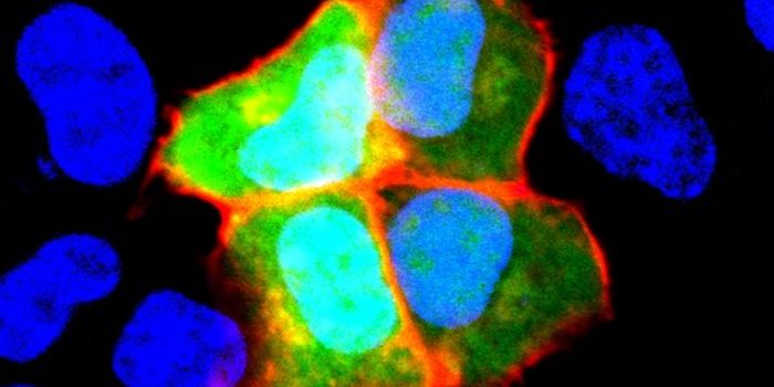 Is Autoimmunity Related to Schizophrenia?