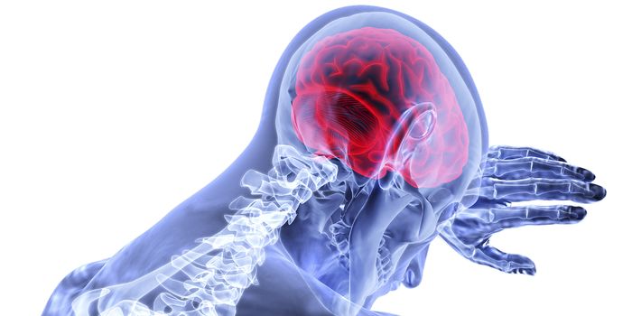 Identifying a Prognostic Biomarker for Neurological Deterioration After a Stroke