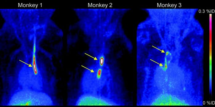 Glycoproteins Specific Ligand Offers a New Way to Probe Blood Clots