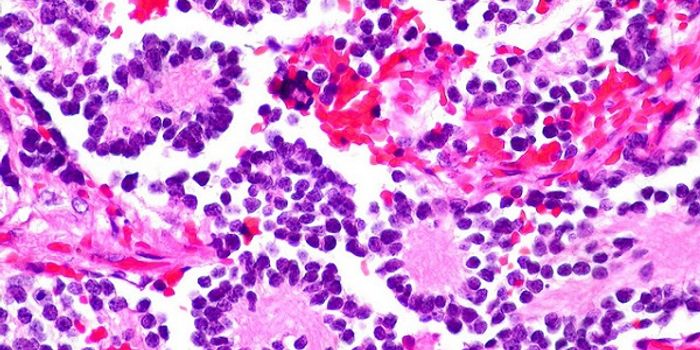 Shedding Light on Chemo