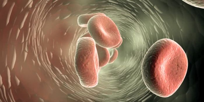 Elastic Fibers in Arterial Walls Contribute to Plaque Buildup