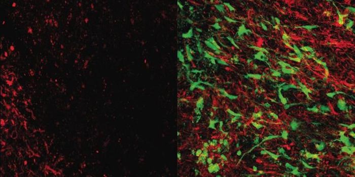 Stem Cell Treatment for Dementia is Promising in Model