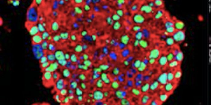 An Innovative way to Study Bladder Cancer