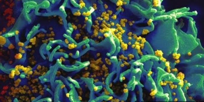 Study Finds HIV Becoming 'Watered Down' Over Time