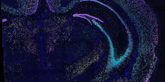 Diagramming Connections in the Brain with Barcodes