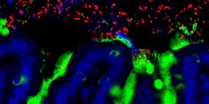 Is Our Gut Microbiome Affecting Our Decision Making?